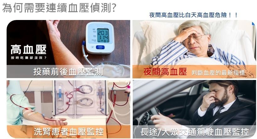 Optical Pressure-free continuous blood pressure monitoring technology｜TIE